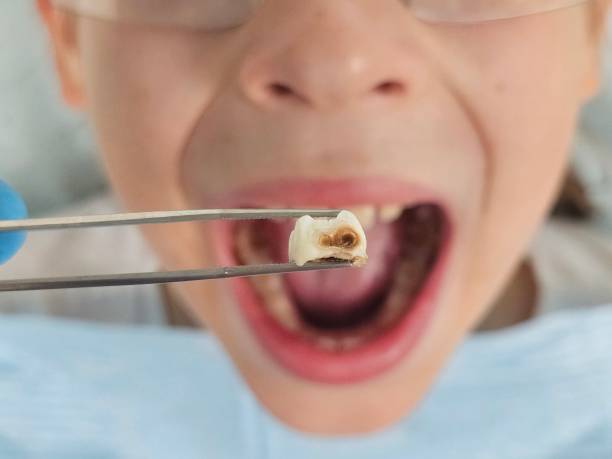 Best Same-Day Emergency Dental Services in Montoursville, PA